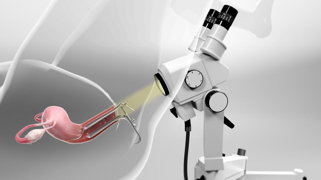 medical lab equipment cervical sample