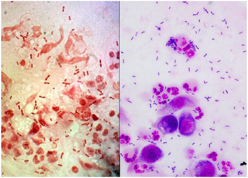 Micrografía de Moraxella