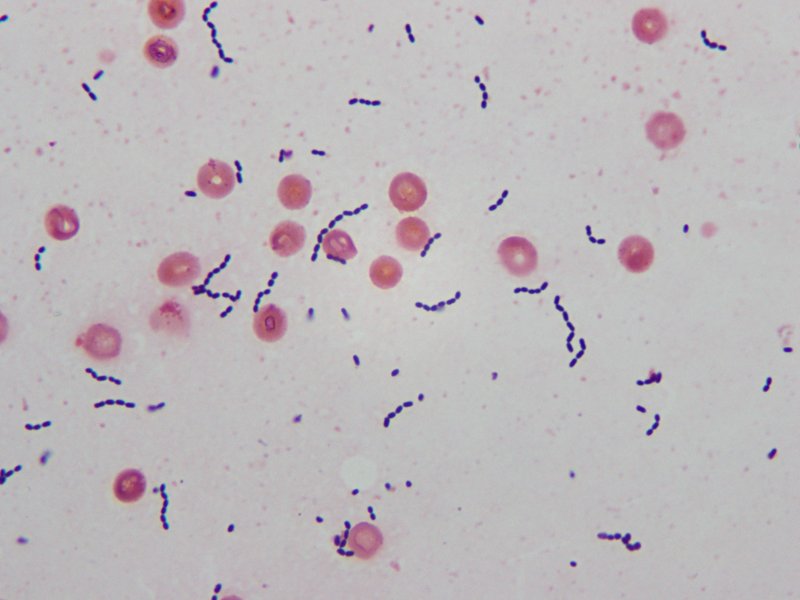 Colonias de Streptococcus agalactiae (Grupo B) en agar sangre
