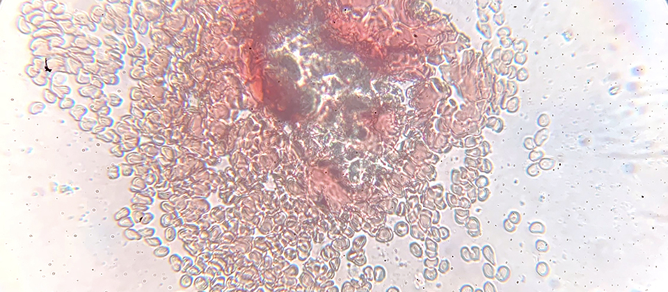 microscopic view of blood cells