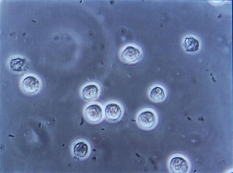 comprendre-traiter-prevenir-la-cystite-cg3wc668