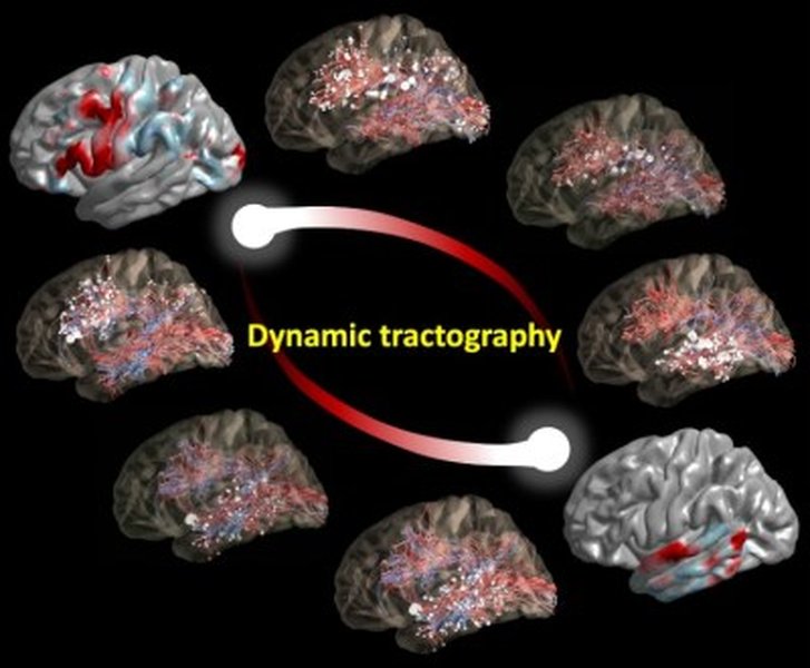 consciousness-attention-language-processing-0sd6w94w