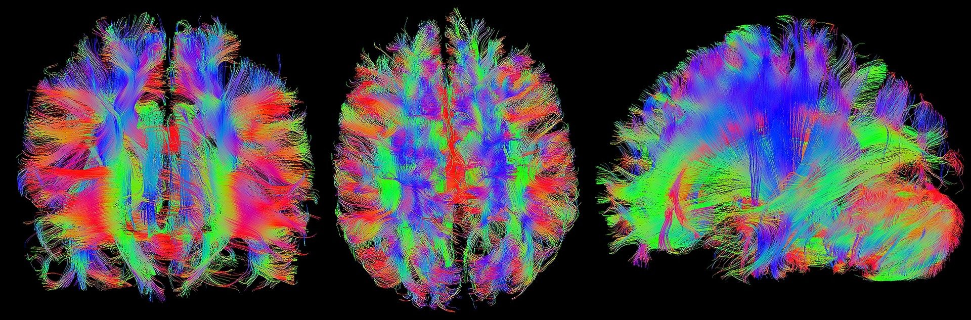 neural network brain activity