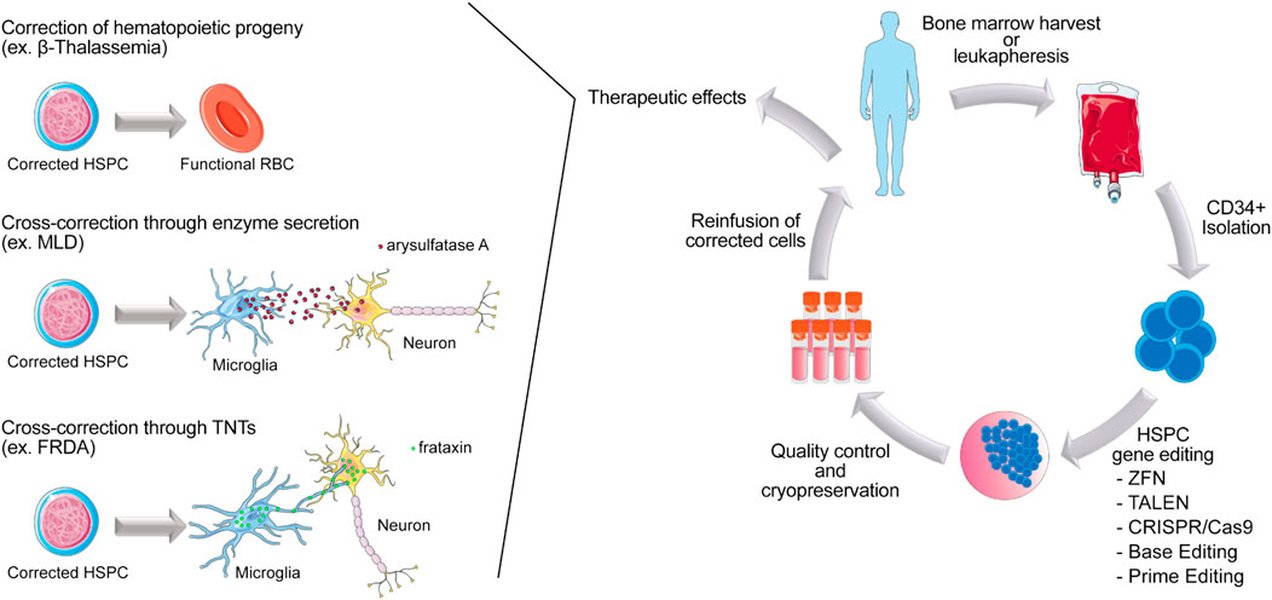 Esquema de la terapia génica ex vivo con células madre hematopoyéticas