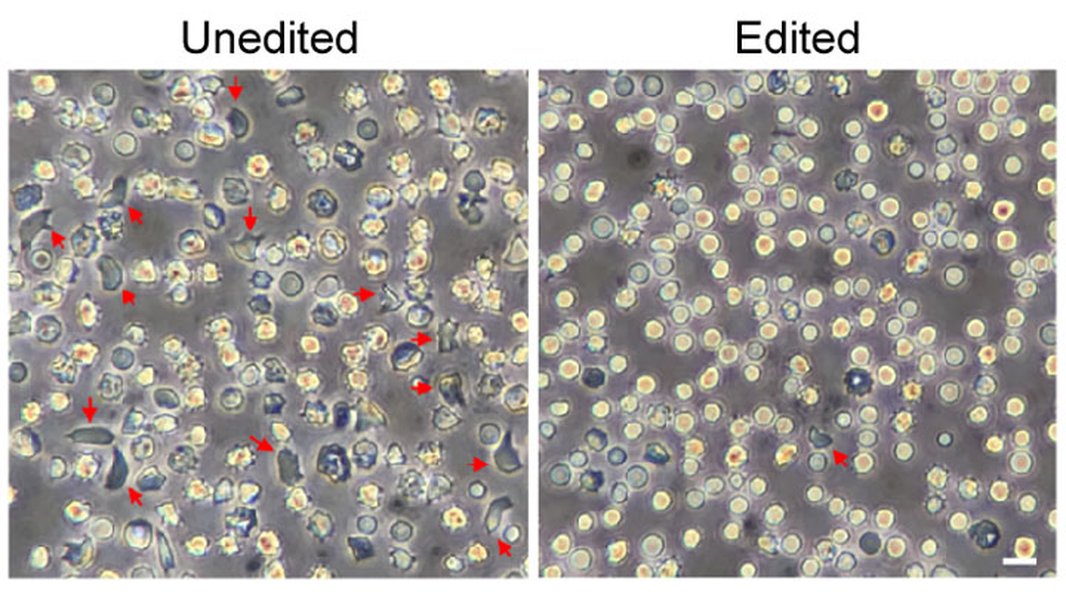 crispr-anemia-falciforme-modelo-experimental-2i2zdtnn