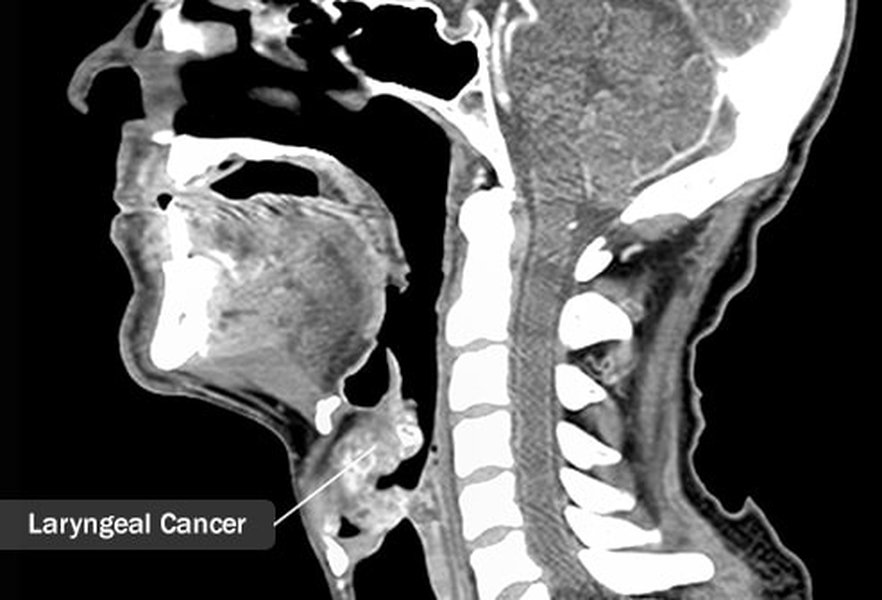 ct-neck-tumor-anatomical-description-vfjequo2