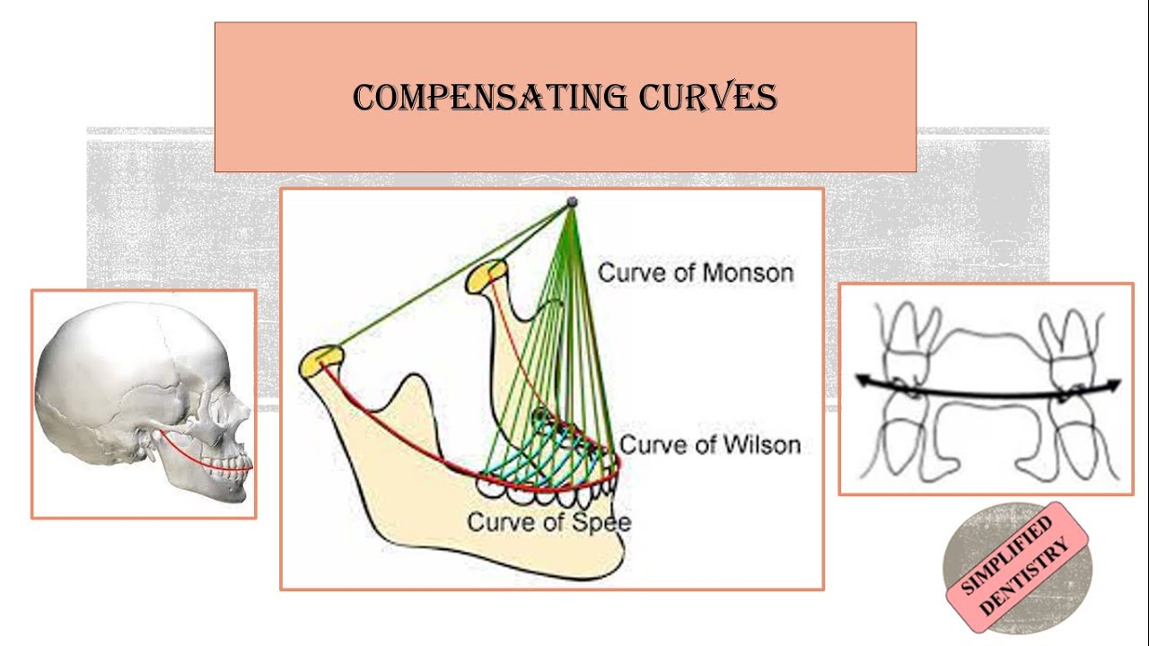 dental curve of wilson