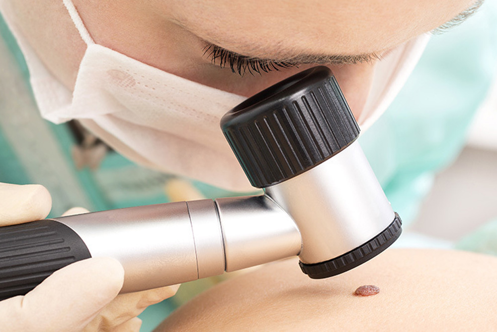 dermatologist examining skin under microscope