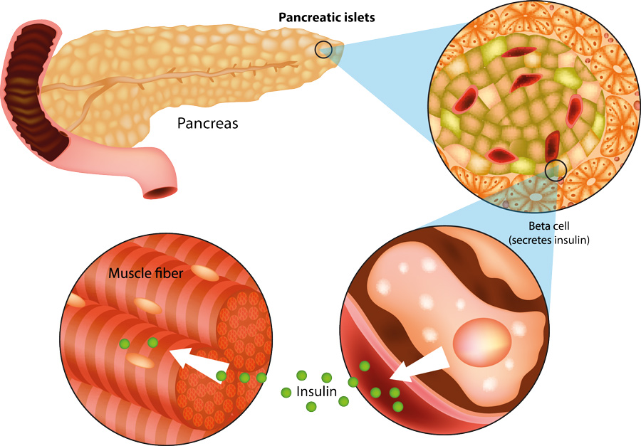 pancreatic beta cells healthy food