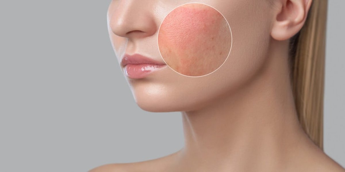 facial inflammation clinic