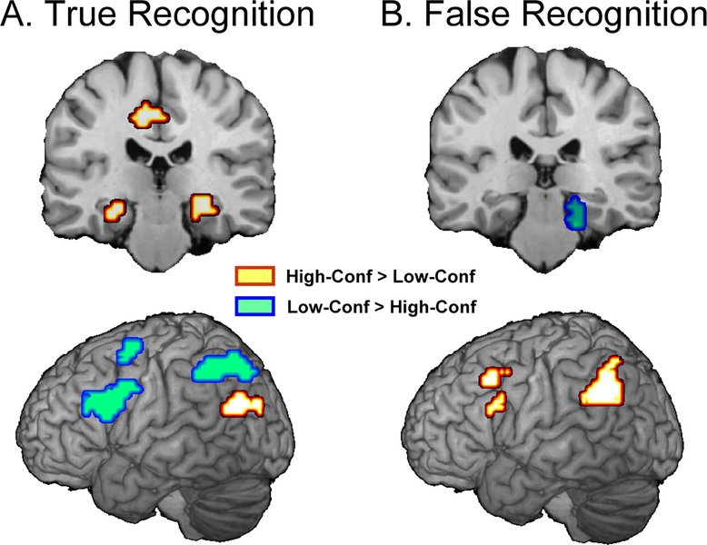 Neuroscience figure showing brain regions involved in memory
