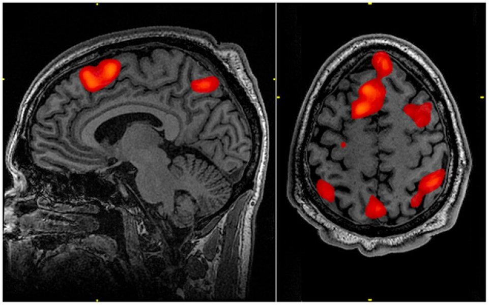 differentiating-genuine-false-memories-science-h7zljwvb