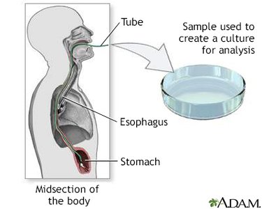 gastric endoscopy and genetic testing laboratory