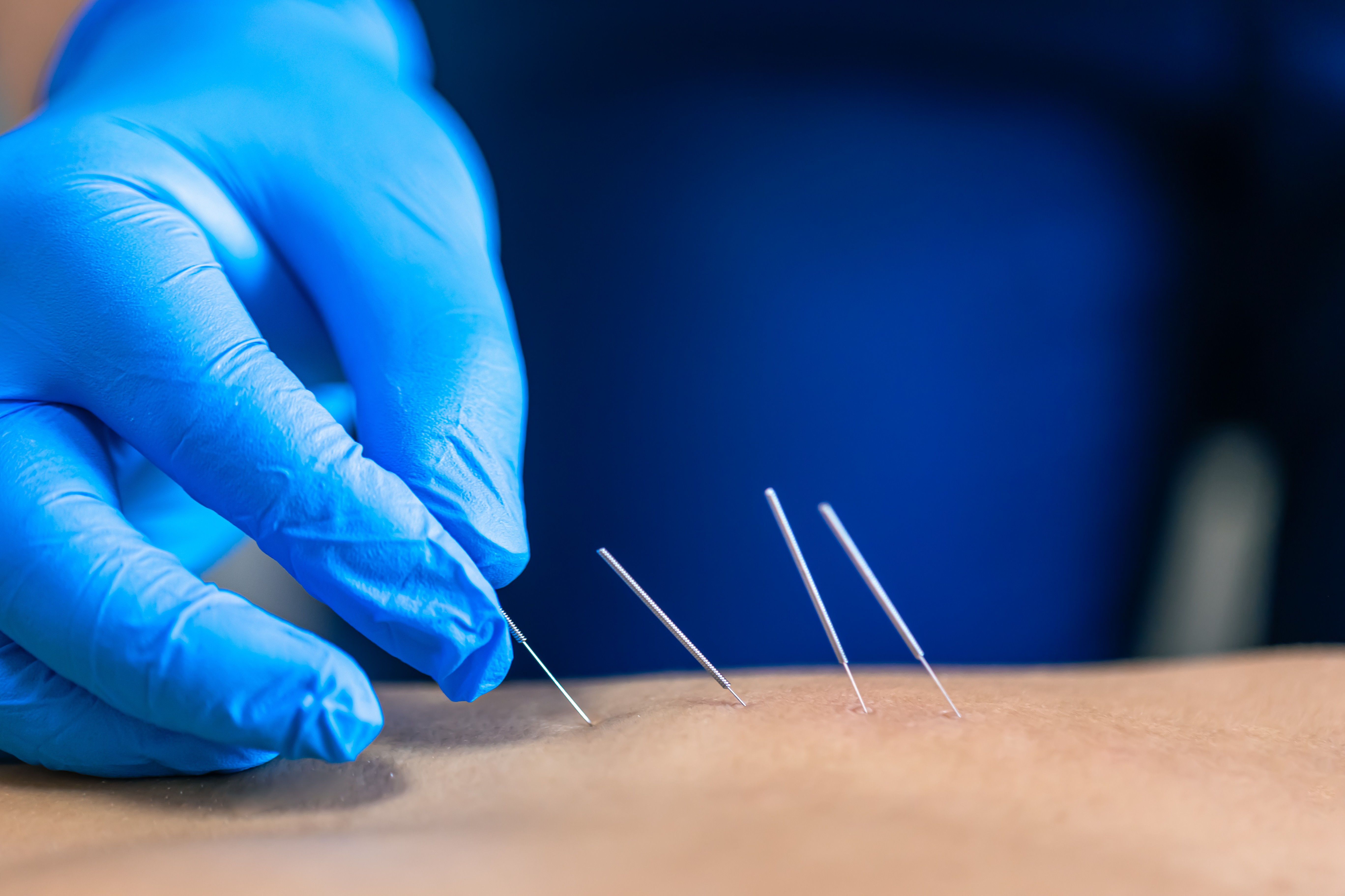 needle therapy session rural clinic