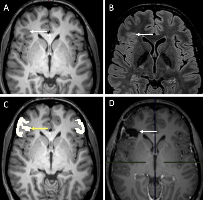 MRI clinical data analysis