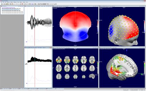 eeg analysis setup