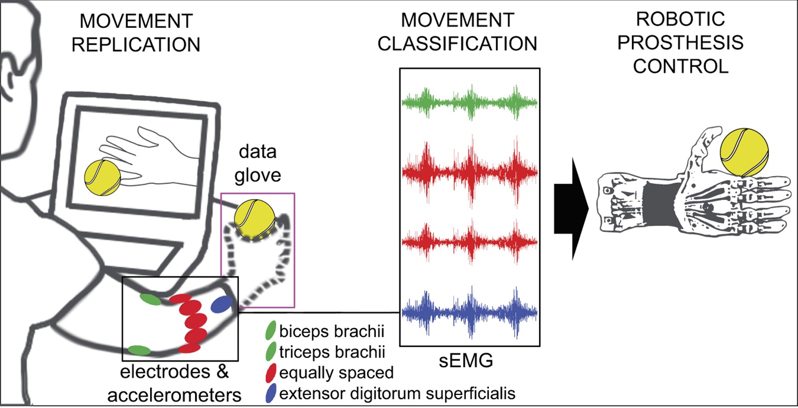 advanced prosthetic robotic arm and EMG electrodes