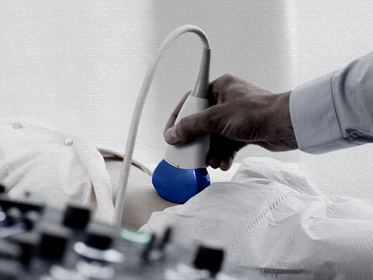 ovarian kista ultrasound scan medical equipment