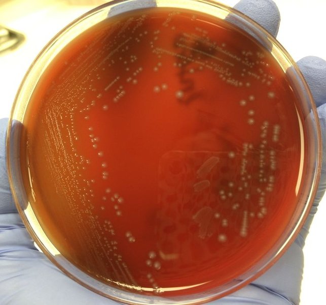 Colonias de Enterococcus faecalis en agar sangre (BAP)