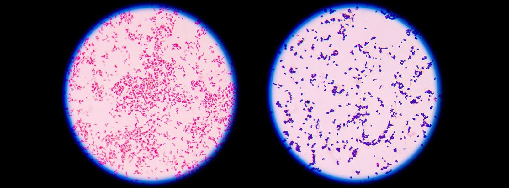 estreptococos-microbiologia-detallada-aedsrahk