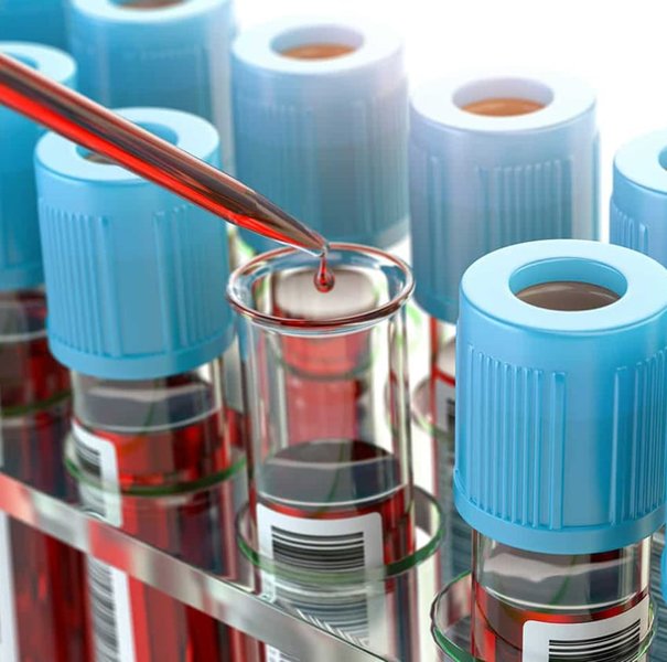 laboratory equipment and clinical samples