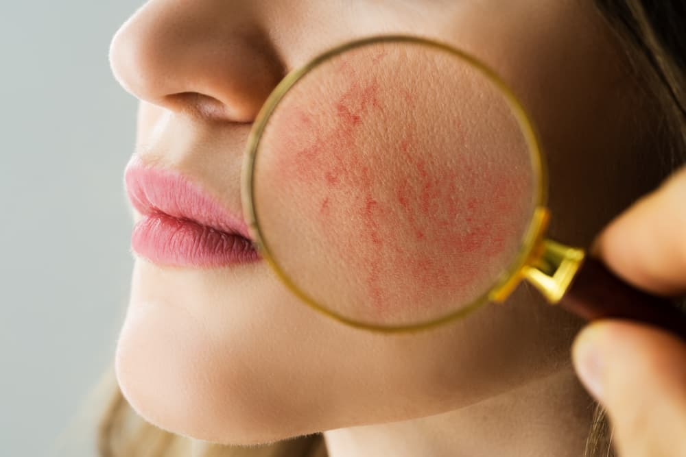anti inflammatory foods, herbal compress, facial skincare regimen