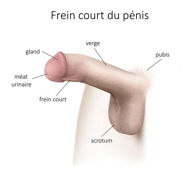 frenulum-removal-circumcision-decision-7c0rdkpr