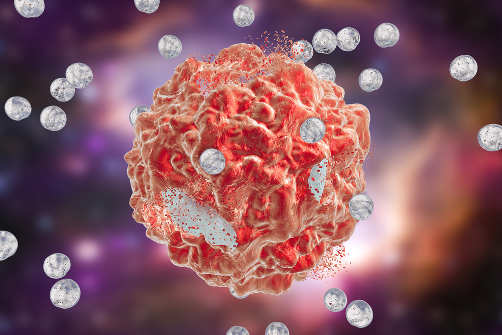advanced nanotechnology in cancer treatment