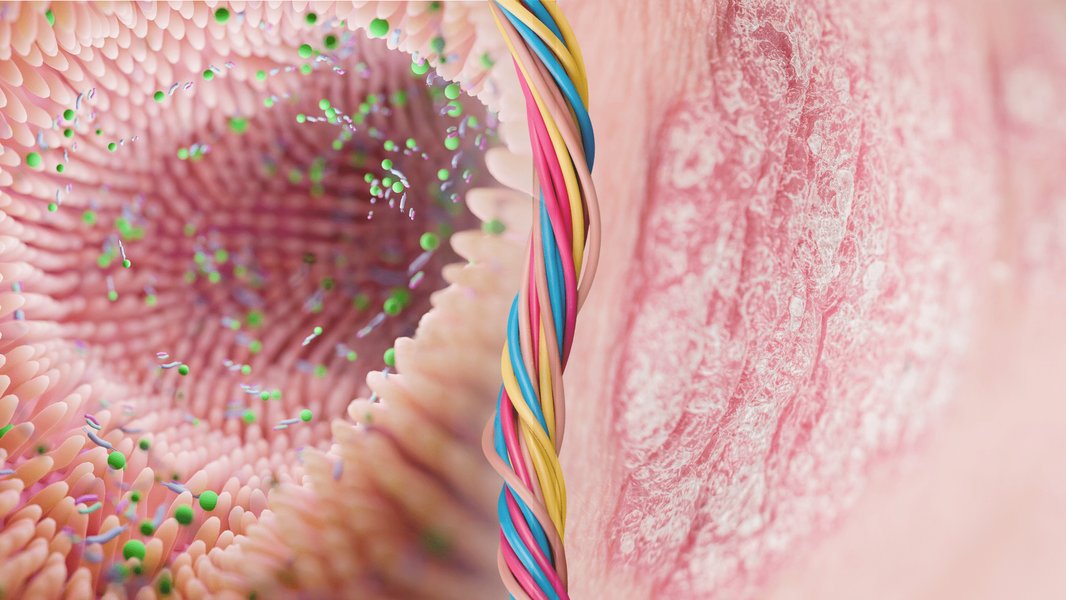 gut-microbiome-psoriasis-connection-vi6eeb7q