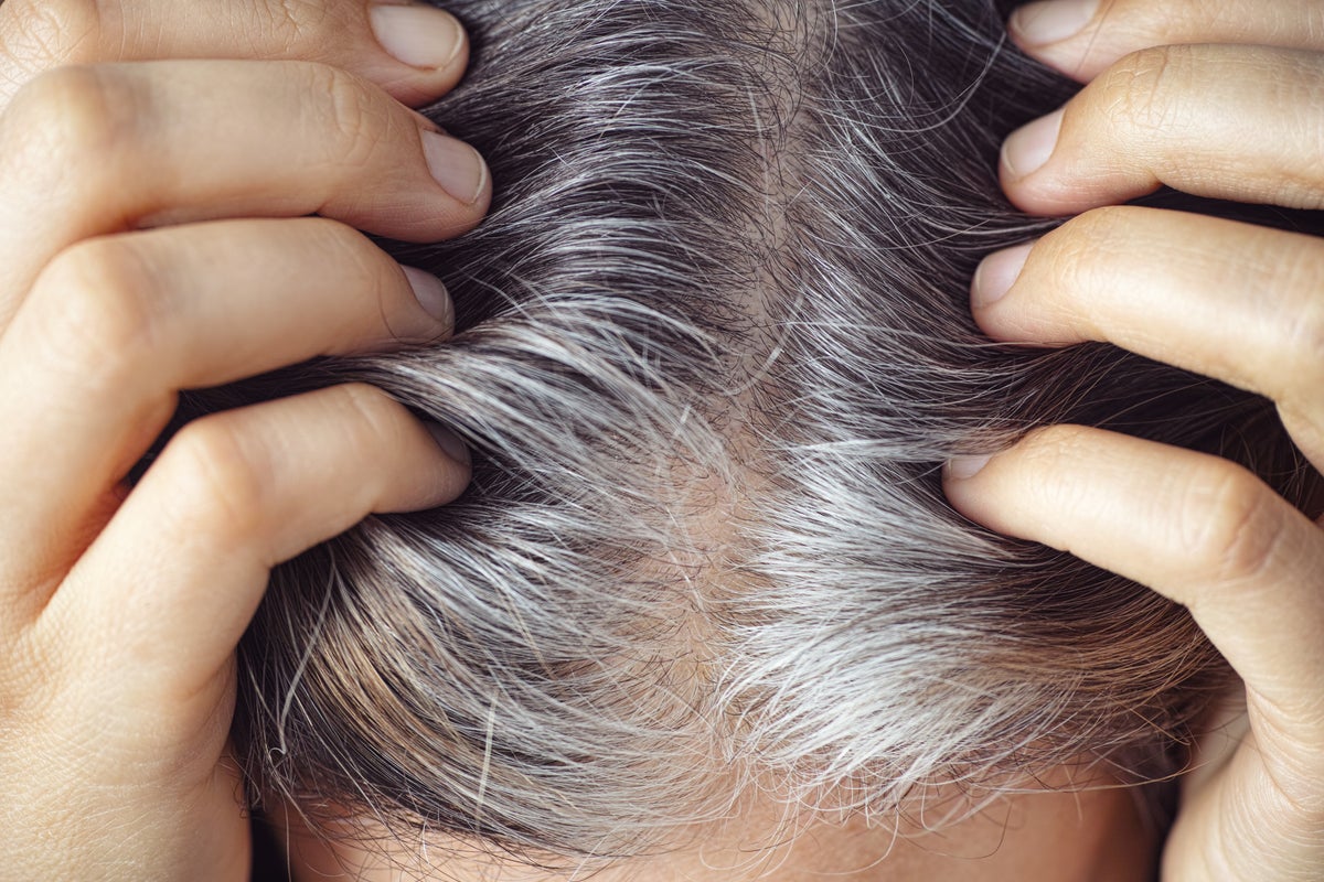 aging hair follicles natural landscapes