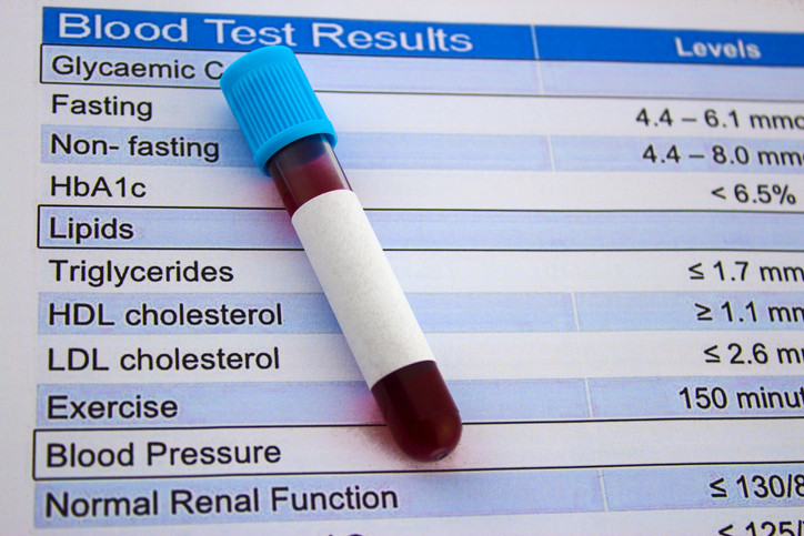 blood test, cholesterol, healthy lifestyle