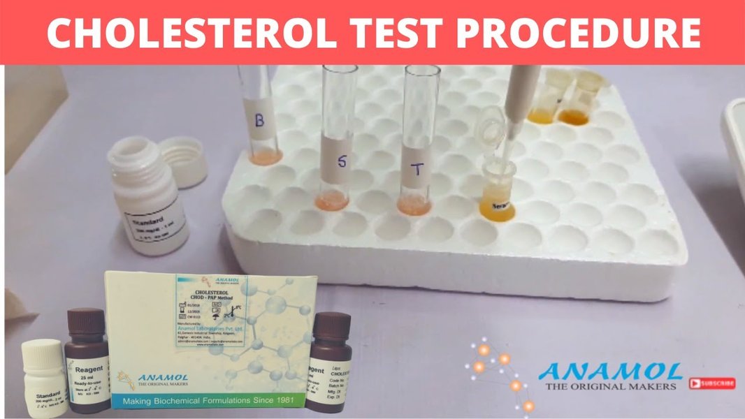cholesterol test laboratory