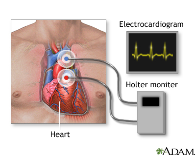 heart pathology medical equipment