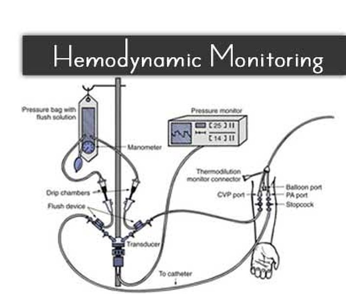 hemodynamic-monitor-best-practices-miuenwvh
