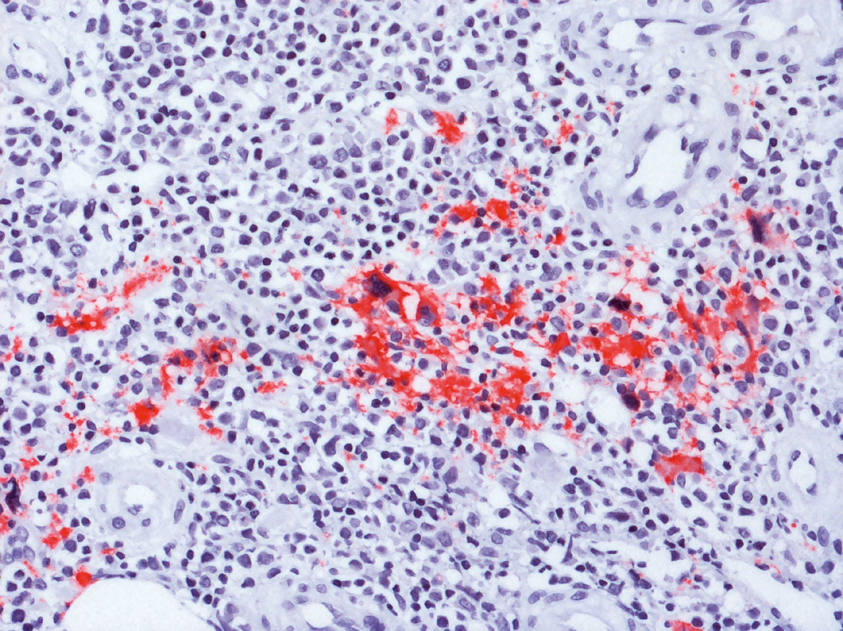 microscope laboratory histology tissue sections