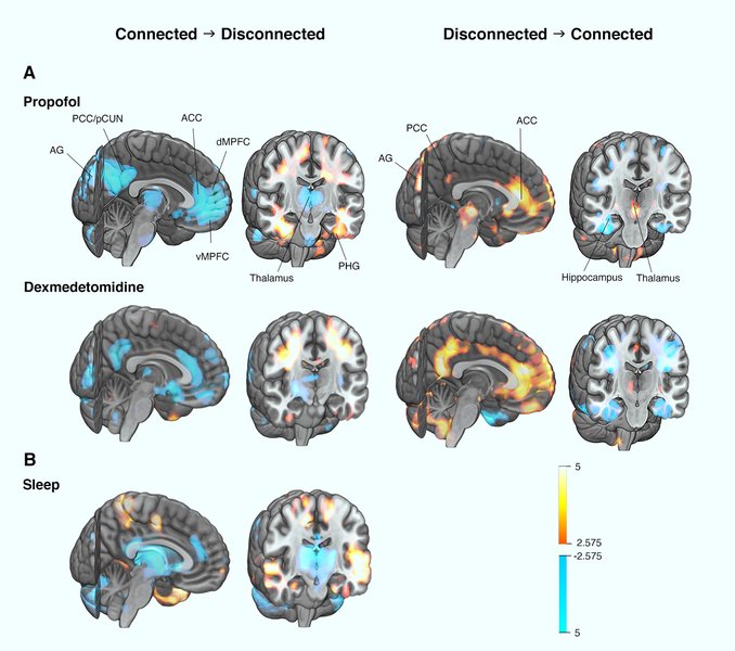 how-consciousness-works-explained-qbj771wg
