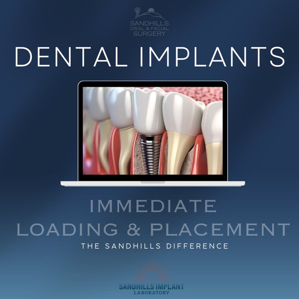 immediate-loading-implants-success-j19be6rr
