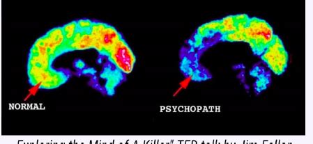 sociopath psychopath differences