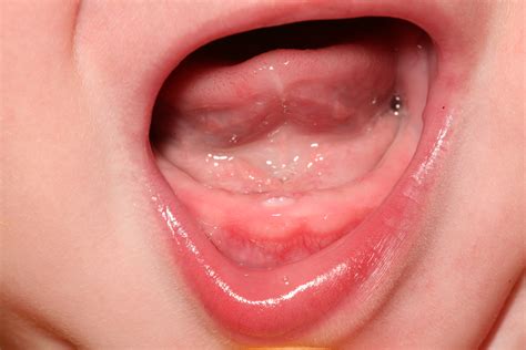 baby teething relief