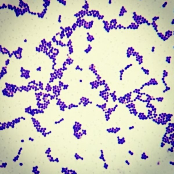 informe-staphylococcus-cocos-grampositivos-murray-odn73b2n