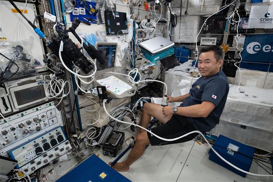 international-space-station-longevity-qleaebfv