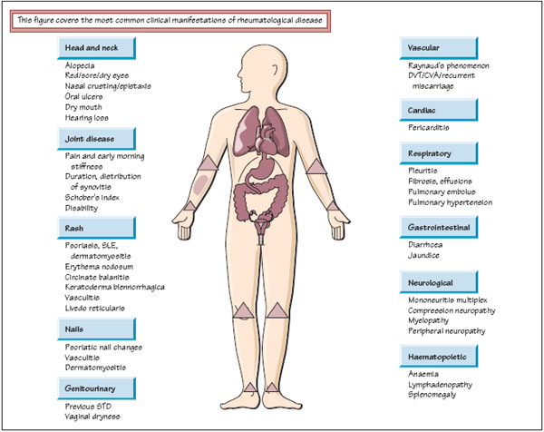 rheumatism joints clinic exam