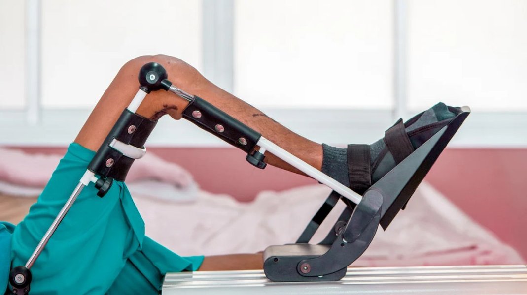 knee-replacement-12-week-rehab-x35771u7