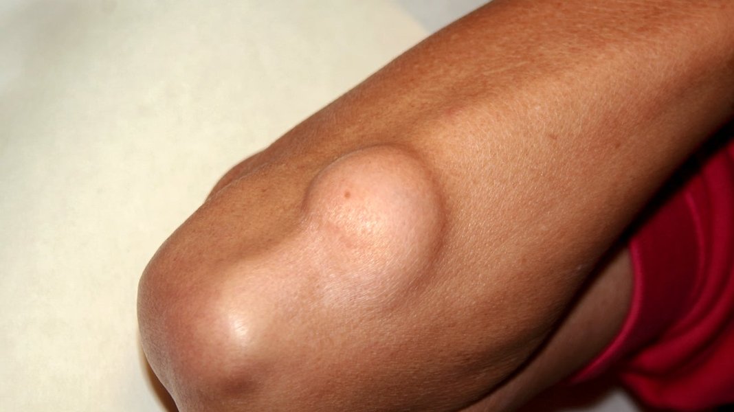 large-soft-arm-mass-l4na7be6
