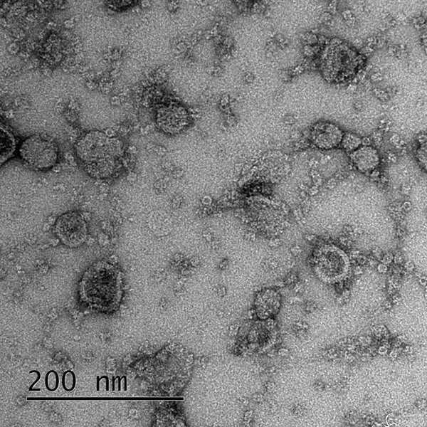 latest-methods-neuron-specific-ev-isolation-qfk04d9u