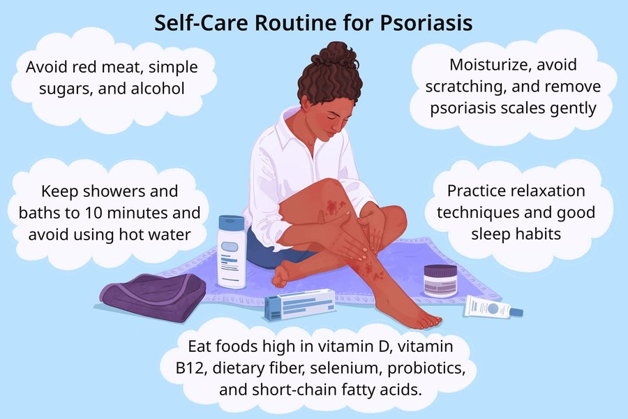 Psoriasis self-care items like moisturizer and gentle soap