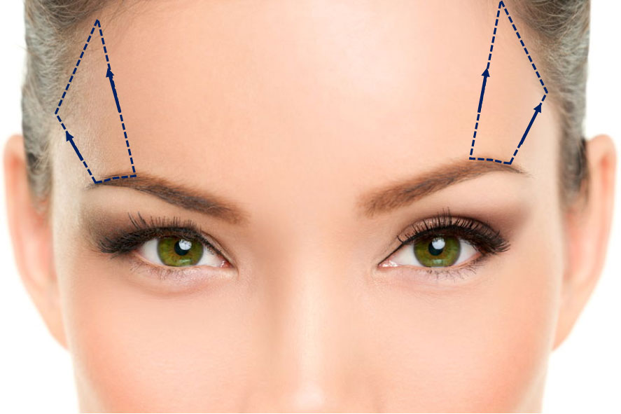chirurgie frontal sourcils