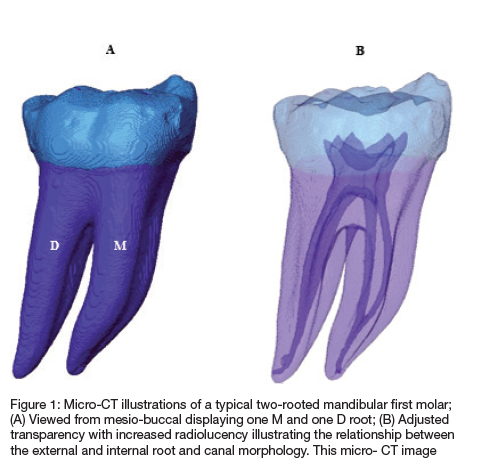 mandibular first molar anatomy