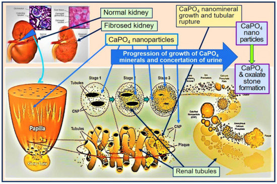 kidney disruption landscape