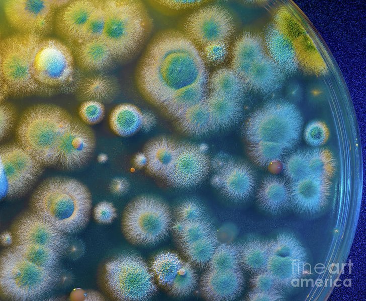 microbiology-gpt-failure-analysis-cyqnh3bg